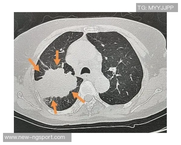 卡洛斯因心脏问题住院后获准出院将进行后续复查确保健康状况稳定